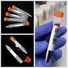 15 ml MĖGMENIS 40 Vnt. PLASTIKINIAI KŪGINIAI LABORATORINIAI TARPAI ILGUS
