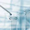 Bez Marki LABORATORINĖS MENTELĖS 18 Vnt. NERŪDIJANČIO PLIENO MIKRO Šaukštelių rinkinys