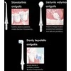 Osom Professional Burnos irigatorius OSOM Oral Care OSOMORAL131BL, juodas