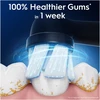 Dantų šepetėlis „Oral B iO“ serijos „Gentle Care“ keičiamos dantų šepetėlio galvutės – juodos – 3 vnt.