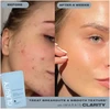 Imarais Beauty IMARIAS BEAUTY - CLARITY - GUMINUKAI NUO SPŪKIŲ Žaliasis obuolys - 30 vnt.