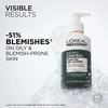 „L'Oréal Professionnel Men Expert Derma Control“ valomasis gelis jautriai odai, 260 ml