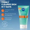 Nivea DERMA Skin Clear šveitiklis, 150 ml