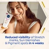 Nivea Luminous630 kūno kremas nuo žymių ir dėmių, 200 ml