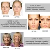 Anti-aging masažuoklis veidui ir kaklui