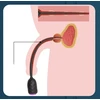 Vibruojanti šlaplės lazdelė Vibrating Penis Plug, 5 mm