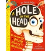 KNYGA Suzie Edge Hole in the Head, A gruesomely grisly history of medical firsts