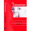 KNYGA Bookshop Caesarean