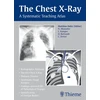 KNYGA Bookshop Chest X-Ray