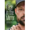 KNYGA Jack El Hai Face Transplant