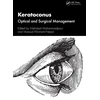 KNYGA Mehrdad Mohammadpour Keratoconus