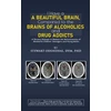 KNYGA DVM, PhD, Stewart Odendhal I Have a Beautiful Brain, Compared to the Brains of Alcoholics and Drug Addicts