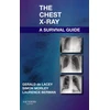 KNYGA Gerald De Lacey Chest X-Ray: A Survival Guide