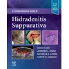 KNYGA Vivian Comprehensive Guide to Hidradenitis Suppurativa