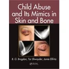 KNYGA B G Brogdon Child Abuse and its Mimics in Skin and Bone
