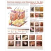 KNYGA Bookshop Common Lesions and Disorders of the Skin Anatomical Chart