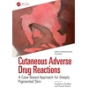 KNYGA Bookshop Cutaneous Adverse Drug Reactions