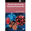 KNYGA Bookshop Severe Community Acquired Pneumonia