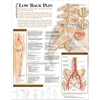 KNYGA Bookshop Understanding Low Back Pain Anatomical Chart