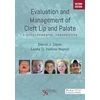 KNYGA David J Zajac Evaluation and Management of Cleft Lip and Palate