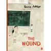 KNYGA Emma Adbage Wound