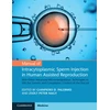 KNYGA Gianpiero D Palermo Manual of Intracytoplasmic Sperm Injection in Human Assisted Reproduction