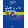 KNYGA Jean Nicolas Vauthey Colorectal Liver Metastasis