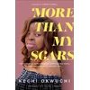 KNYGA Kechi Okwuchi More Than My Scars – The Power of Perseverance, Unrelenting Faith, and Deciding What Defines You