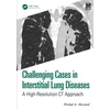 KNYGA Khaled A Abuzeid Challenging Cases in Interstitial Lung Diseases