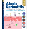 KNYGA Lawrence S Chan Atopic Dermatitis: Inside Out or Outside In