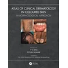 KNYGA P C Das Atlas of Clinical Dermatology in Coloured Skin