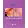 KNYGA Ronald Marks Facial Skin Disorders