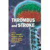 KNYGA Bookshop Thrombus and Stroke