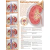 KNYGA Bookshop Understanding Kidney Cancer Anatomical Chart
