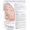 KNYGA Bookshop Understanding Lung Cancer Anatomical Chart