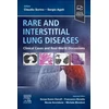 KNYGA Claudio Sorino Rare and Interstitial Lung Diseases