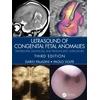 KNYGA Dario Paladini Ultrasound of Congenital Fetal Anomalies
