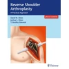 KNYGA David M Dines Reverse Shoulder Arthroplasty