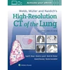 KNYGA Sujal Desai Webb, Muller and Naidich's High-Resolution CT of the Lung