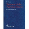 KNYGA T. H. Moss MB Tumours of the Nervous System