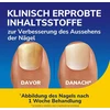 Dr. Scholl's Nail Revitaliser 10ml matomi rezultatai vos per 2 dienas: šviesina, lygina, drėkina, pagerina nagų ir kojų nagų, pažeistų nagų grybelio, išvaizdą