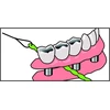 Idontix Brace X-floss tarpdančių siūlas, žalias