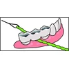 Idontix Brace X-floss tarpdančių siūlas, žalias