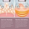 Homedics CELL-500-EU Smoothee Anti Cellulit Vakuuminis masažas Odos lygintuvas