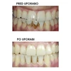 Dantų šepetėlis Silkn ToothWave TW1PE3001