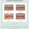 Avéne Cicalfate+ Repair Lūpų balzamas atkuriantis lūpų balzamas, 10 ml
