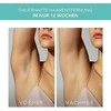 Foreo PEACH 2 prietaisas visam laikui plaukų šalinimui
