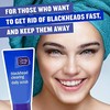 Clean & Clear Peeling gelis nuo inkštirų 150ml