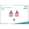 DIGITUS CAT 6 U/UTP pataisos laidas - LSZH