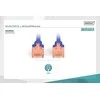 DIGITUS CAT 6 U/UTP pataisos laidas - LSZH